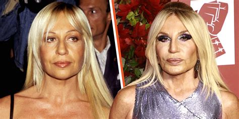 black dress donatella versace|Donatella Versace then and now.